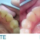 Afacere 4 imagine AS DENT OTOPENI Stomatologi şi cabinete stomatologice în Otopeni IF