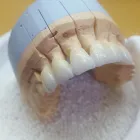 Afacere 5 imagine DENTAMIR - LABORATOR DENTAR CAD CAM Stomatologi şi cabinete stomatologice în Oradea BH