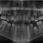 Afacere 5 imagine RADIOLOGIE DENTARA DIGITALA - POLICLINICA DENTARA BOTOSANI Stomatologi şi cabinete stomatologice în Botoşani