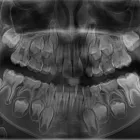 Afacere 6 imagine RADIOLOGIE DENTARA DIGITALA - POLICLINICA DENTARA BOTOSANI Stomatologi şi cabinete stomatologice în Botoşani