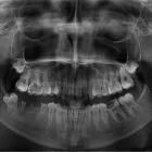 Afacere 7 imagine RADIOLOGIE DENTARA DIGITALA - POLICLINICA DENTARA BOTOSANI Stomatologi şi cabinete stomatologice în Botoşani