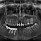 Afacere 9 imagine RADIOLOGIE DENTARA DIGITALA - POLICLINICA DENTARA BOTOSANI Stomatologi şi cabinete stomatologice în Botoşani