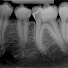 Afacere 10 imagine RADIOLOGIE DENTARA DIGITALA - POLICLINICA DENTARA BOTOSANI Stomatologi şi cabinete stomatologice în Botoşani