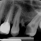 Afacere 11 imagine RADIOLOGIE DENTARA DIGITALA - POLICLINICA DENTARA BOTOSANI Stomatologi şi cabinete stomatologice în Botoşani