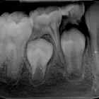 Afacere 12 imagine RADIOLOGIE DENTARA DIGITALA - POLICLINICA DENTARA BOTOSANI Stomatologi şi cabinete stomatologice în Botoşani