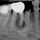 Afacere 13 imagine RADIOLOGIE DENTARA DIGITALA - POLICLINICA DENTARA BOTOSANI Stomatologi şi cabinete stomatologice în Botoşani