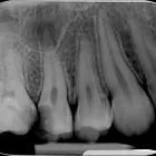 Afacere 14 imagine RADIOLOGIE DENTARA DIGITALA - POLICLINICA DENTARA BOTOSANI Stomatologi şi cabinete stomatologice în Botoşani