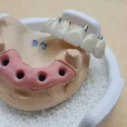 Afacere 12 imagine SC DENTAMIR SRL - LABORATOR DENTAR CAD CAM Stomatologi şi cabinete stomatologice în Oradea BH