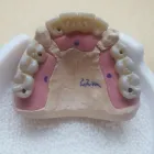 Afacere 13 imagine SC DENTAMIR SRL - LABORATOR DENTAR CAD CAM Stomatologi şi cabinete stomatologice în Oradea BH