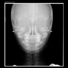 Afacere 1 imagine VIZIODENT-XRAY DIAGNOSTIC IMAGING SERVICES BY DENTALALEX Sănătate şi Medicină în Braşov