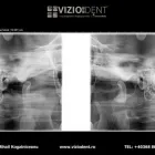 Afacere 2 imagine VIZIODENT-XRAY DIAGNOSTIC IMAGING SERVICES BY DENTALALEX Sănătate şi Medicină în Braşov