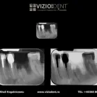 Afacere 3 imagine VIZIODENT-XRAY DIAGNOSTIC IMAGING SERVICES BY DENTALALEX Sănătate şi Medicină în Braşov