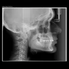 Afacere 4 imagine VIZIODENT-XRAY DIAGNOSTIC IMAGING SERVICES BY DENTALALEX Sănătate şi Medicină în Braşov