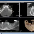 Afacere 5 imagine VIZIODENT-XRAY DIAGNOSTIC IMAGING SERVICES BY DENTALALEX Sănătate şi Medicină în Braşov