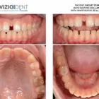 Afacere 6 imagine VIZIODENT-XRAY DIAGNOSTIC IMAGING SERVICES BY DENTALALEX Sănătate şi Medicină în Braşov