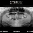 Afacere 7 imagine VIZIODENT-XRAY DIAGNOSTIC IMAGING SERVICES BY DENTALALEX Sănătate şi Medicină în Braşov