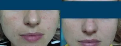 Afacere 1 imagine CENTRUL MEDICAL DR. MIHALCEANU Stomatologi şi cabinete stomatologice în Timişoara TM