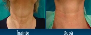 Afacere 2 imagine CENTRUL MEDICAL DR. MIHALCEANU Stomatologi şi cabinete stomatologice în Timişoara TM