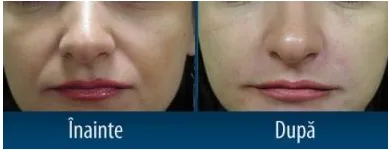 Afacere 3 imagine CENTRUL MEDICAL DR. MIHALCEANU Stomatologi şi cabinete stomatologice în Timişoara TM