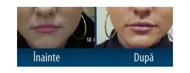 Afacere 4 imagine CENTRUL MEDICAL DR. MIHALCEANU Stomatologi şi cabinete stomatologice în Timişoara TM