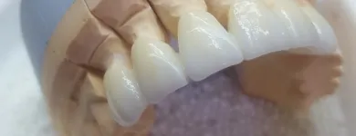 Afacere 5 imagine DENTAMIR - LABORATOR DENTAR CAD CAM Stomatologi şi cabinete stomatologice în Oradea BH