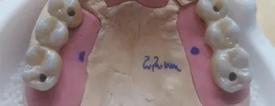 Afacere 7 imagine DENTAMIR - LABORATOR DENTAR CAD CAM Stomatologi şi cabinete stomatologice în Oradea BH