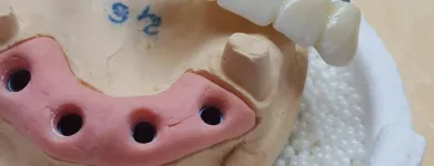 Afacere 10 imagine DENTAMIR - LABORATOR DENTAR CAD CAM Stomatologi şi cabinete stomatologice în Oradea BH