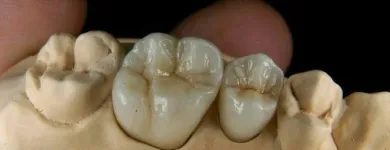 Afacere 1 imagine LABORATOR TEHNICA DENTARA HANGANU Stomatologi şi cabinete stomatologice în Ploieşti PH
