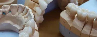 Afacere 2 imagine SC DENTAMIR SRL - LABORATOR DENTAR CAD CAM Stomatologi şi cabinete stomatologice în Oradea BH