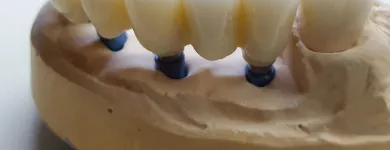 Afacere 8 imagine SC DENTAMIR SRL - LABORATOR DENTAR CAD CAM Stomatologi şi cabinete stomatologice în Oradea BH