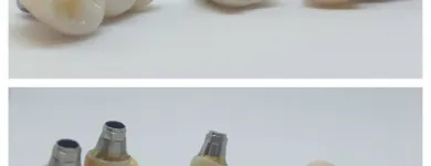 Afacere 11 imagine SC DENTAMIR SRL - LABORATOR DENTAR CAD CAM Stomatologi şi cabinete stomatologice în Oradea BH