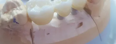 Afacere 15 imagine SC DENTAMIR SRL - LABORATOR DENTAR CAD CAM Stomatologi şi cabinete stomatologice în Oradea BH