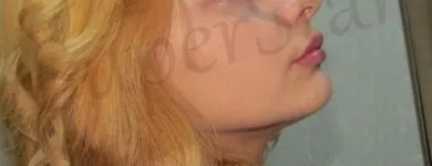 Afacere 7 imagine SUPERSTAR BRAILA Sănătate şi Medicină în Brăila