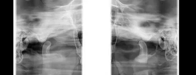 Afacere 2 imagine VIZIODENT-XRAY DIAGNOSTIC IMAGING SERVICES BY DENTALALEX Sănătate şi Medicină în Braşov