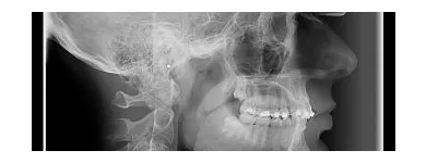 Afacere 4 imagine VIZIODENT-XRAY DIAGNOSTIC IMAGING SERVICES BY DENTALALEX Sănătate şi Medicină în Braşov