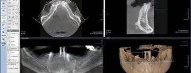 Afacere 5 imagine VIZIODENT-XRAY DIAGNOSTIC IMAGING SERVICES BY DENTALALEX Sănătate şi Medicină în Braşov