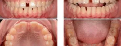 Afacere 6 imagine VIZIODENT-XRAY DIAGNOSTIC IMAGING SERVICES BY DENTALALEX Sănătate şi Medicină în Braşov