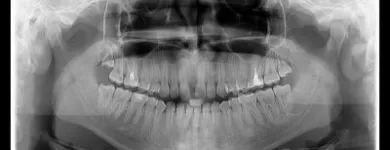 Afacere 7 imagine VIZIODENT-XRAY DIAGNOSTIC IMAGING SERVICES BY DENTALALEX Sănătate şi Medicină în Braşov